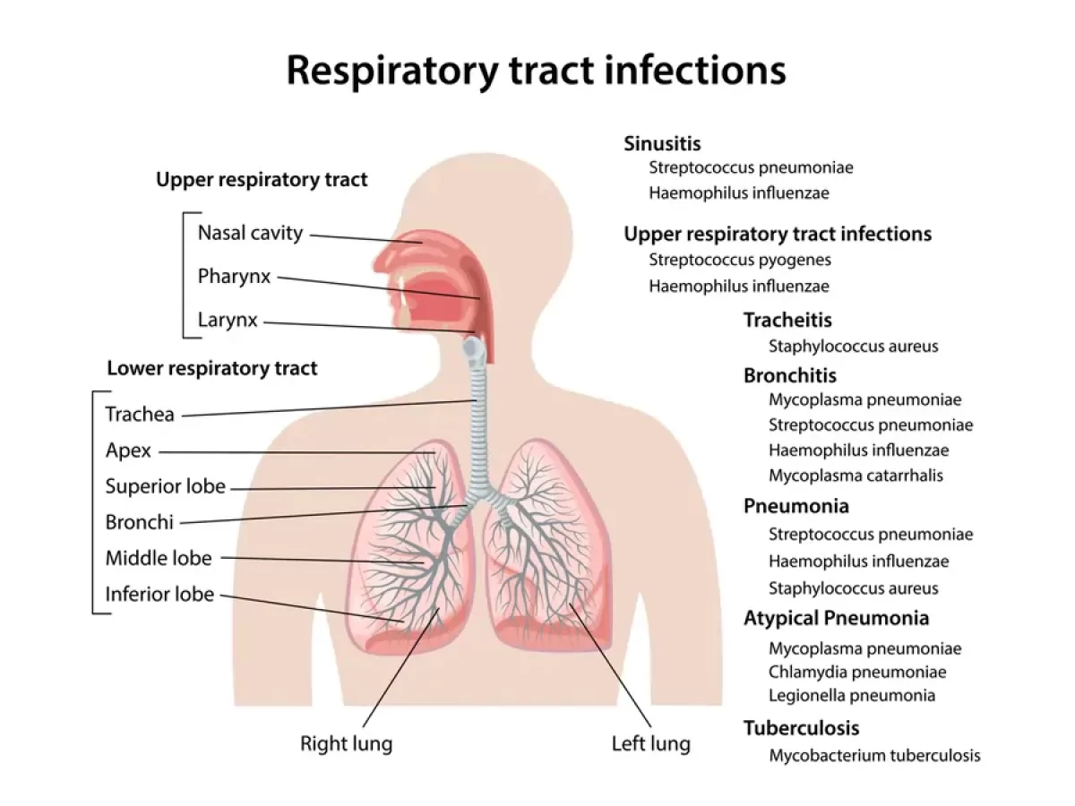 Upper vs Lower Respiratory Infections: Key Differences?