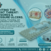 Pressure Ulcers